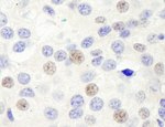 GTF3C1/TFIIIC220 Antibody in Immunohistochemistry (IHC)