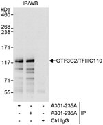GTF3C2/TFIIIC110 Antibody in Immunoprecipitation (IP)