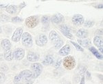 GTF3C2/TFIIIC110 Antibody in Immunohistochemistry (IHC)