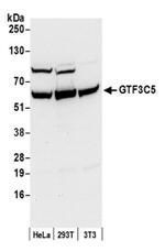 GTF3C5/TFIIIC63 Antibody in Western Blot (WB)