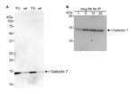 Galectin-7 Antibody in Western Blot (WB)