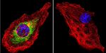 Glucocorticoid Receptor Antibody in Immunocytochemistry (ICC/IF)