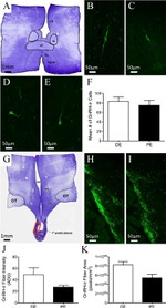 GnRH1 Antibody in Immunohistochemistry - Free Floating (IHC (Free))