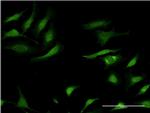 SERPINA3 Antibody in Immunocytochemistry (ICC/IF)