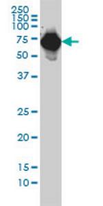 AFP Antibody in Western Blot (WB)