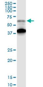 AGER Antibody in Western Blot (WB)