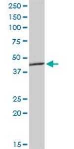 AGER Antibody in Western Blot (WB)