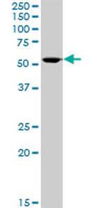 ALDH3A1 Antibody in Western Blot (WB)