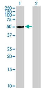 ALDH3A1 Antibody in Western Blot (WB)