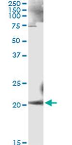 ANK1 Antibody in Immunoprecipitation (IP)