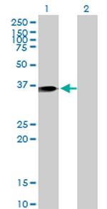 ANXA1 Antibody in Western Blot (WB)