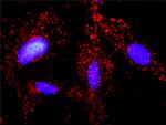 APC Antibody in Proximity Ligation Assay (PLA) (PLA)