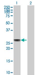 APOA1 Antibody in Western Blot (WB)