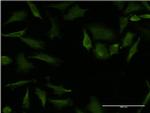 RHOA Antibody in Immunocytochemistry (ICC/IF)