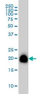 RHOA Antibody in Western Blot (WB)