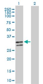 SERPINC1 Antibody in Western Blot (WB)