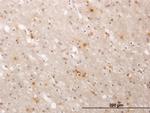 ATP2A1 Antibody in Immunohistochemistry (Paraffin) (IHC (P))