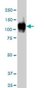 ATP2A1 Antibody in Western Blot (WB)