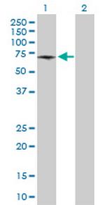 ATP6V1B1 Antibody in Western Blot (WB)