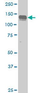 AXL Antibody in Western Blot (WB)