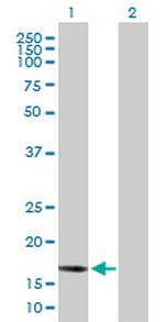 BCL2L2 Antibody in Western Blot (WB)