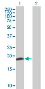 BID Antibody in Western Blot (WB)