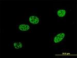 BNIP3L Antibody in Immunocytochemistry (ICC/IF)