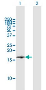 BST2 Antibody in Western Blot (WB)