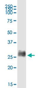 BST2 Antibody in Western Blot (WB)