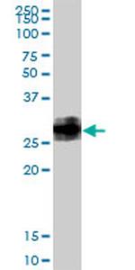 BST2 Antibody in Western Blot (WB)