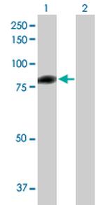 C1S Antibody in Western Blot (WB)