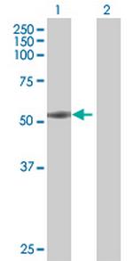 FMNL1 Antibody in Western Blot (WB)