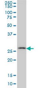 CA7 Antibody in Western Blot (WB)