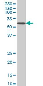 CACNB2 Antibody in Western Blot (WB)