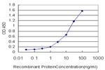 CAMK2B Antibody in ELISA (ELISA)