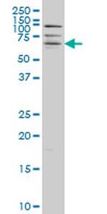 CAMK2B Antibody in Western Blot (WB)