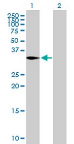 CAPZA2 Antibody in Western Blot (WB)