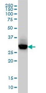 CAPZB Antibody in Western Blot (WB)