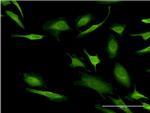 CASP10 Antibody in Immunocytochemistry (ICC/IF)