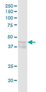 CCNE1 Antibody in Western Blot (WB)