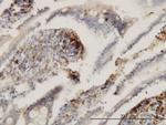 ENTPD6 Antibody in Immunohistochemistry (Paraffin) (IHC (P))