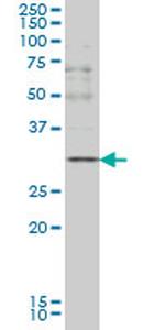 CD40LG Antibody in Western Blot (WB)
