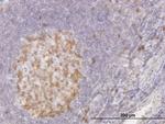 CDC2 Antibody in Immunohistochemistry (Paraffin) (IHC (P))