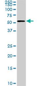 CDK8 Antibody in Western Blot (WB)