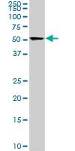 CDK8 Antibody in Western Blot (WB)