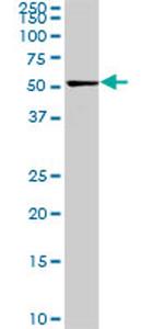 CDK8 Antibody in Western Blot (WB)