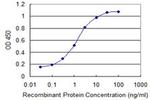 CDR2 Antibody in ELISA (ELISA)