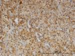 CDR2 Antibody in Immunohistochemistry (Paraffin) (IHC (P))