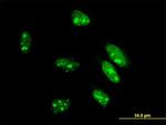 CDX1 Antibody in Immunocytochemistry (ICC/IF)