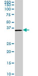 CDX4 Antibody in Western Blot (WB)